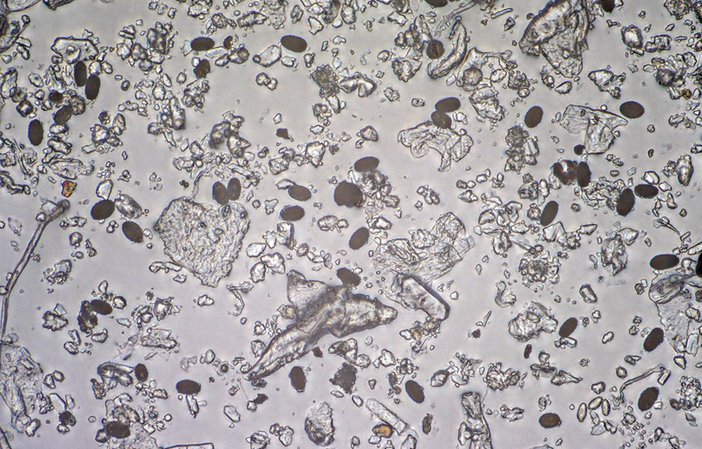 Auszug einer Probe mit extrem viel Stachybotrys-Belastung der Raumluft (schwarze ovale Partikel).